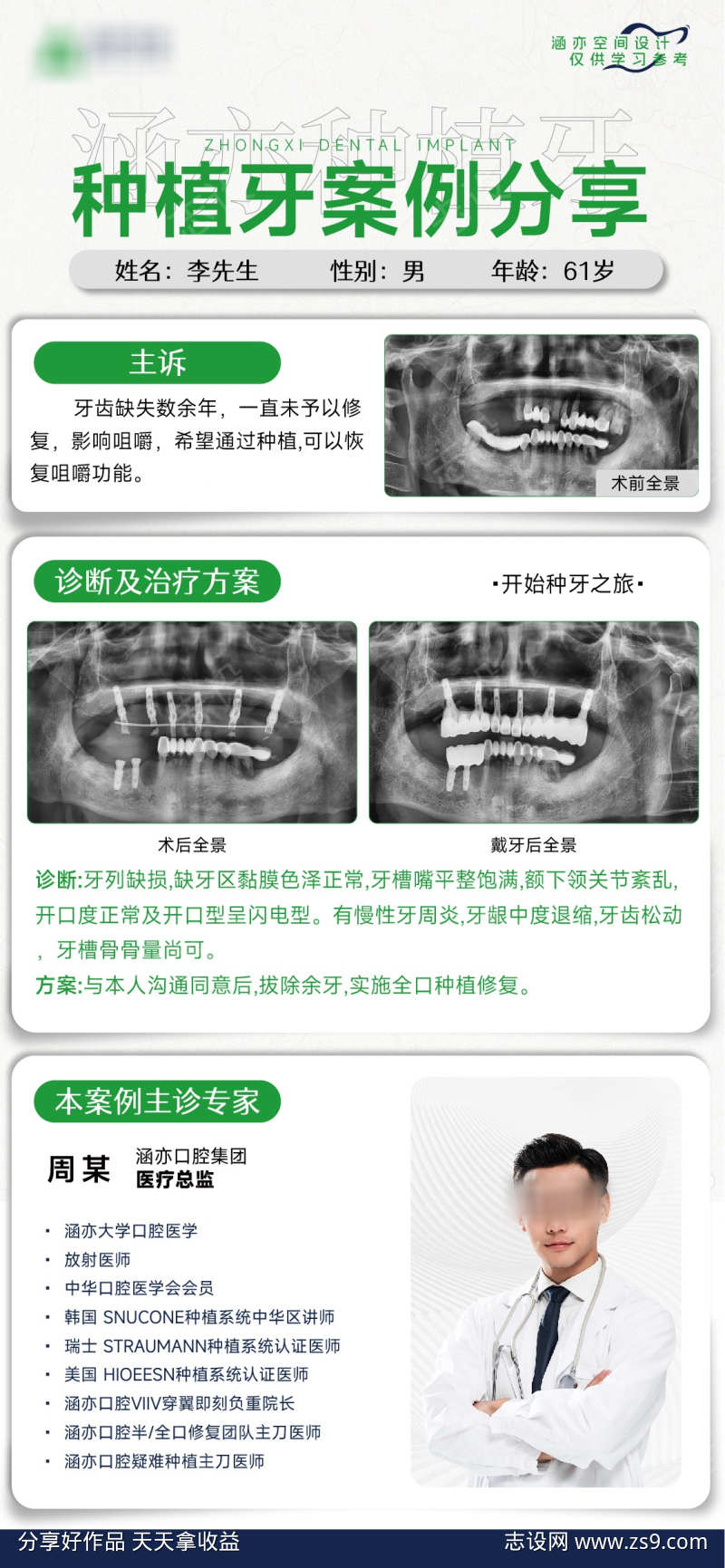 种植牙案例