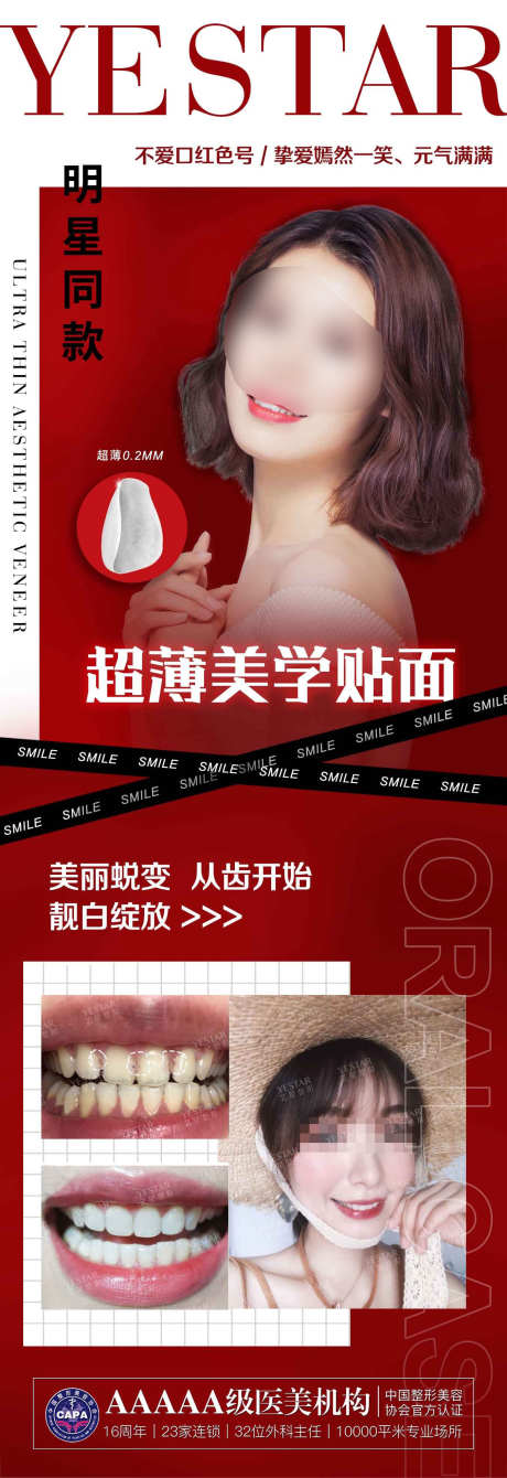 医美口腔宣传图_源文件下载_PSD格式_1352X3937像素-人物,宣传,口腔,贴面,医美,海报-作品编号:2023060417309647-源文件库-ywjfx.cn