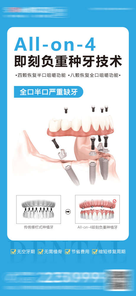 医美口腔种植牙海报_源文件下载_PSD格式_1080X2341像素-宣传,对比图,简约,大气,牙齿,即刻负重,齿科,牙科,海报,种植牙,口腔,医美-作品编号:2023061217568358-源文件库-ywjfx.cn