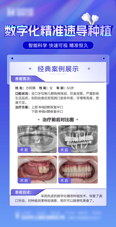 口腔案例海报_源文件下载_PSD格式_750X1465像素-对比,数字化,种植牙,牙齿,海报,案例,口腔-作品编号:2023112916511921-源文件库-ywjfx.cn