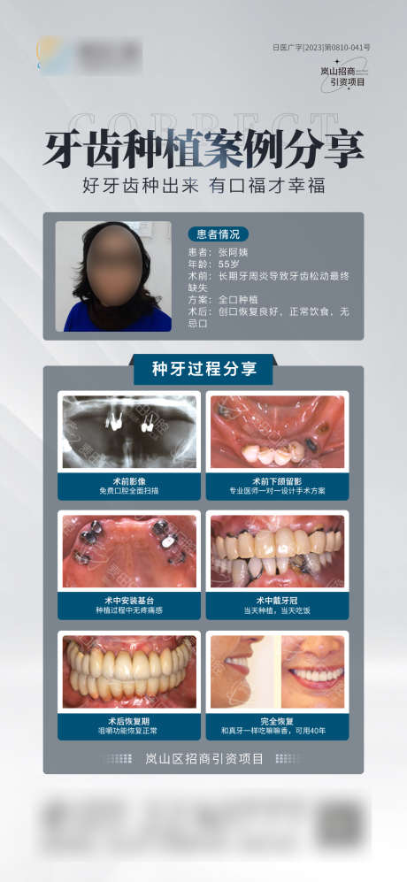 种植牙案例对比_源文件下载_PSD格式_1080X2340像素-卡通,术后,术前,对比,案例,牙齿,种植牙,齿科,医疗,医美,口腔,海报-作品编号:2023122017013526-源文件库-ywjfx.cn