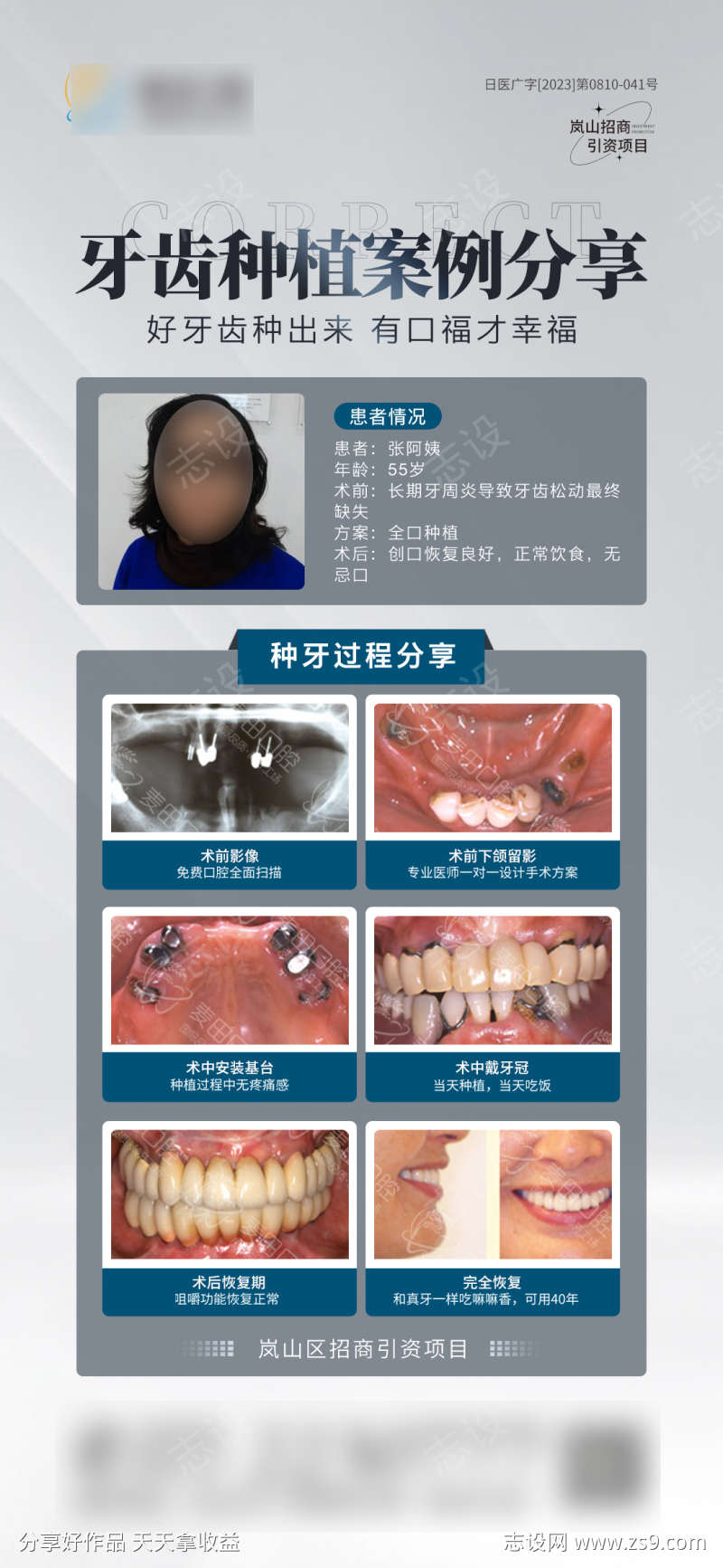 种植牙案例对比