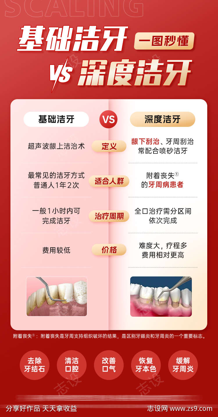 基础洁牙与深度洁牙的区别对比口腔科普