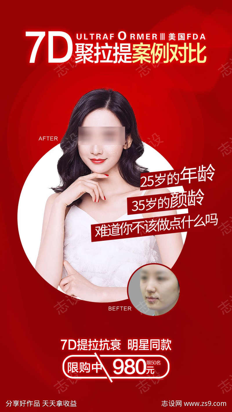 医美案例对比海报