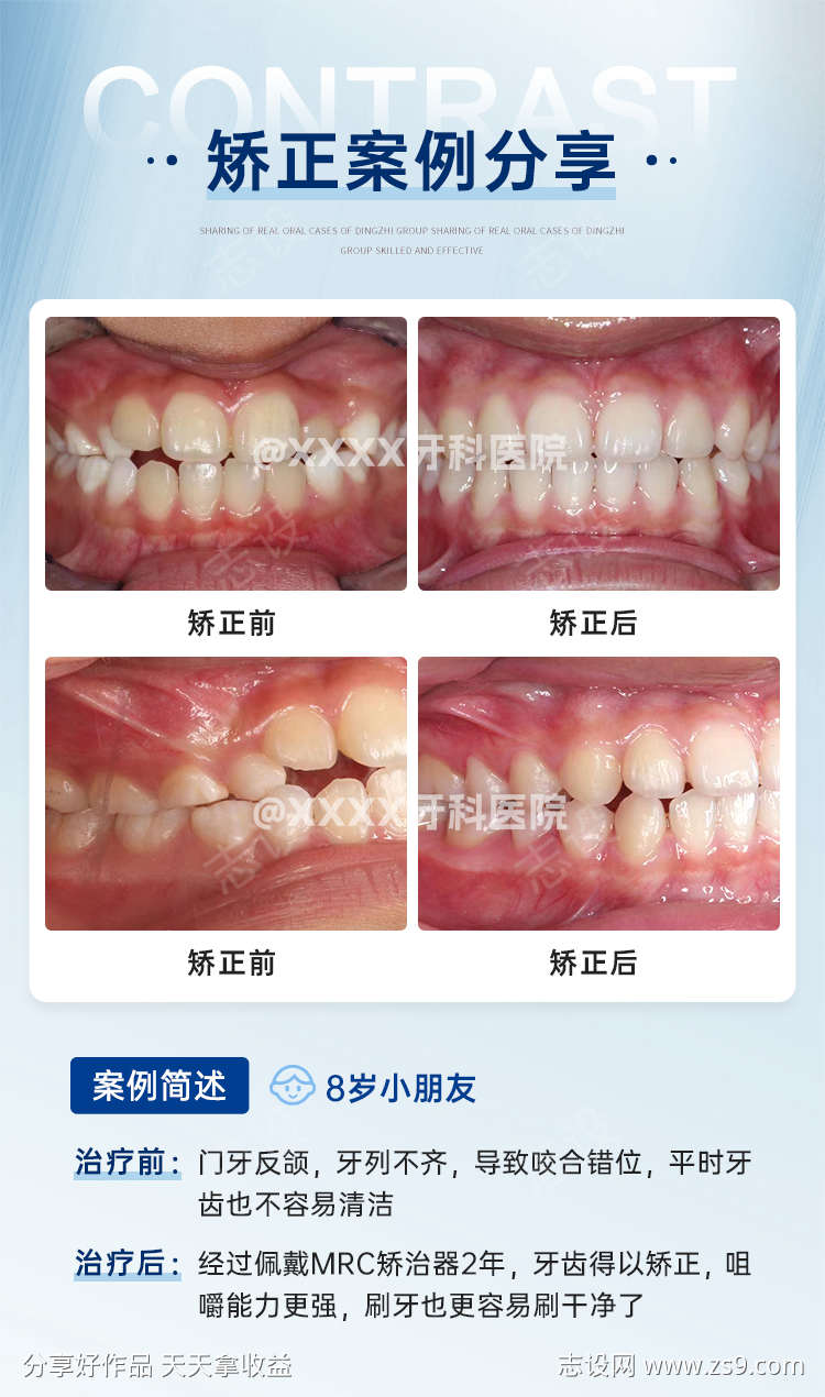 牙齿矫正案例海报