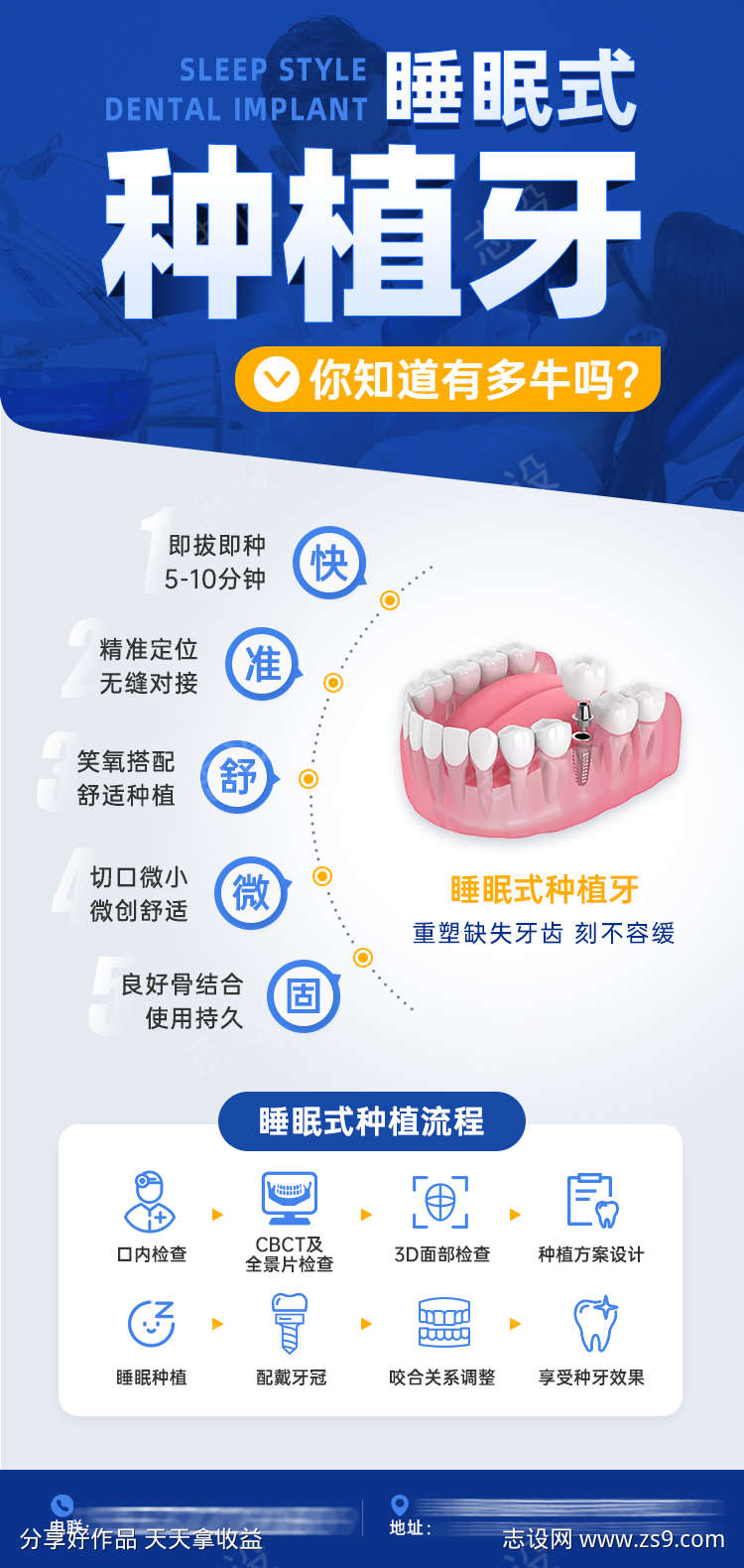 睡眠种植牙优势流程