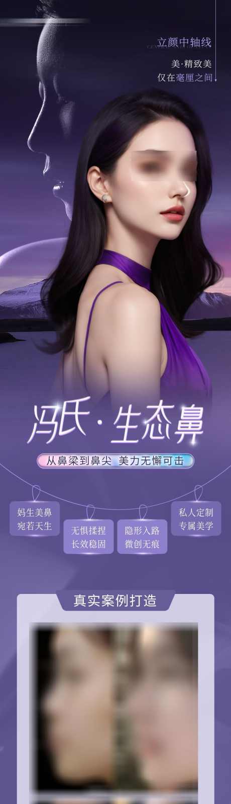 医美鼻整形案例海报_源文件下载_PSD格式_1080X4895像素-案例,海报,长图,生态鼻,妈生鼻,美鼻,鼻整形,医美,美容-作品编号:2024072113385464-志设-zs9.com