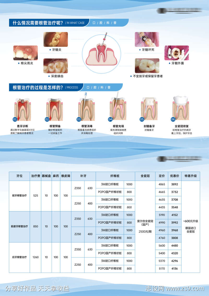 根管治疗步骤科普