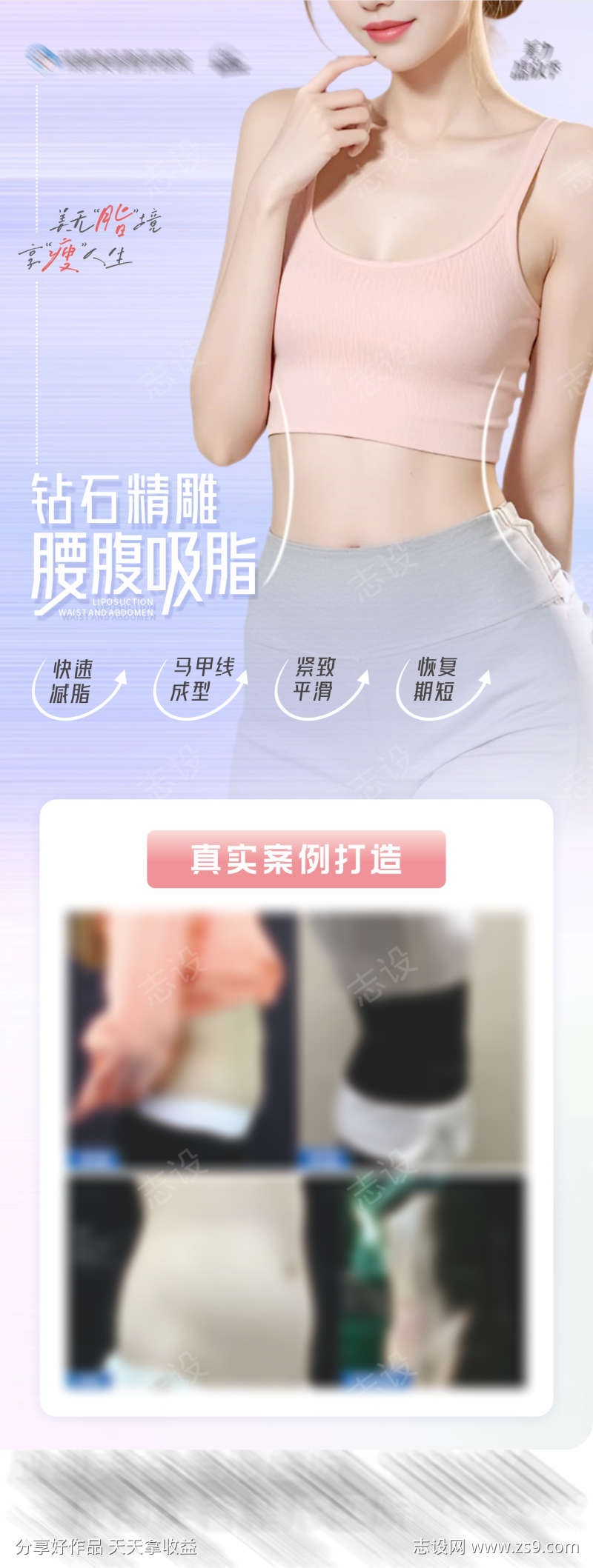 医美美业腰腹吸脂瘦腰塑性案例创意海报