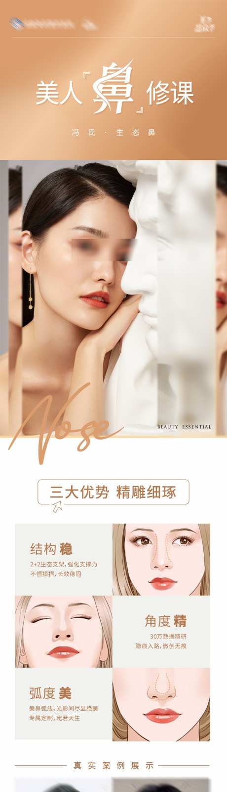 医美整形美鼻隆鼻生态鼻创意海报_源文件下载_CDR格式_1284X5427像素-生态鼻,隆鼻,美鼻,简洁,清新,长图,海报,高端,大气,质感,创意,美容,整形,美业,医美,美女-作品编号:2024102117004530-志设-zs9.com